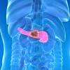 Pancreas